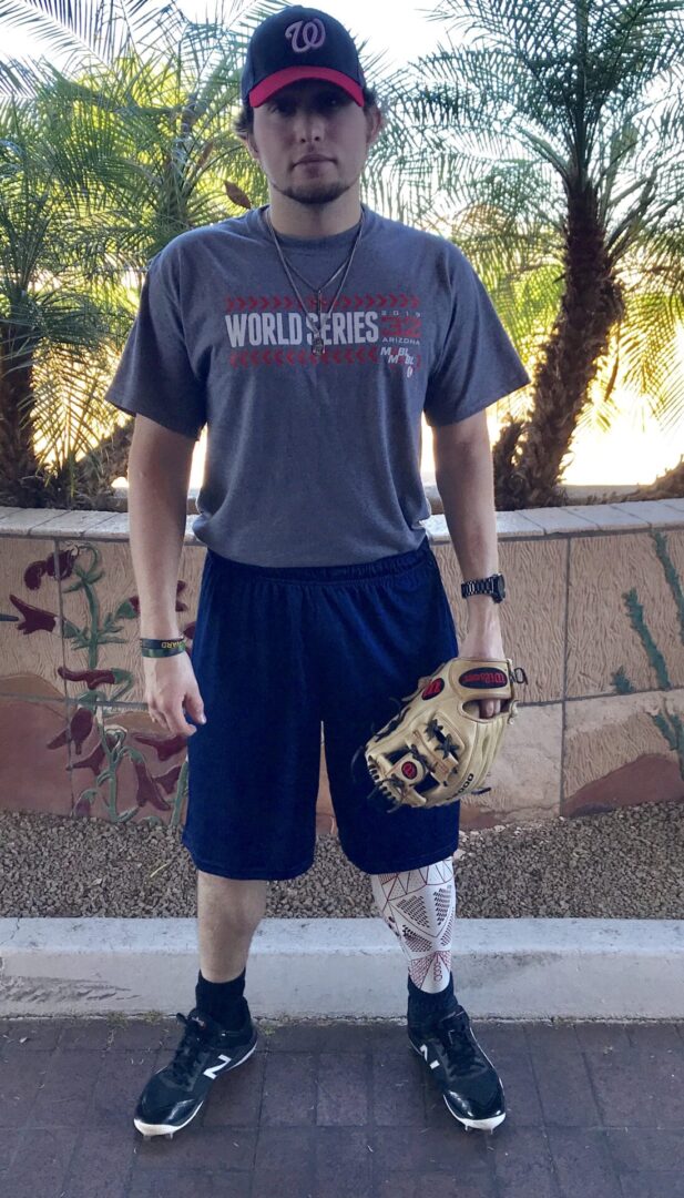 Stephen With a Prosthetic leg and Baseball Gloves
