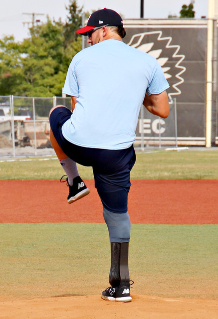 A Man in a Prosthetic Leg Practicing to Ball